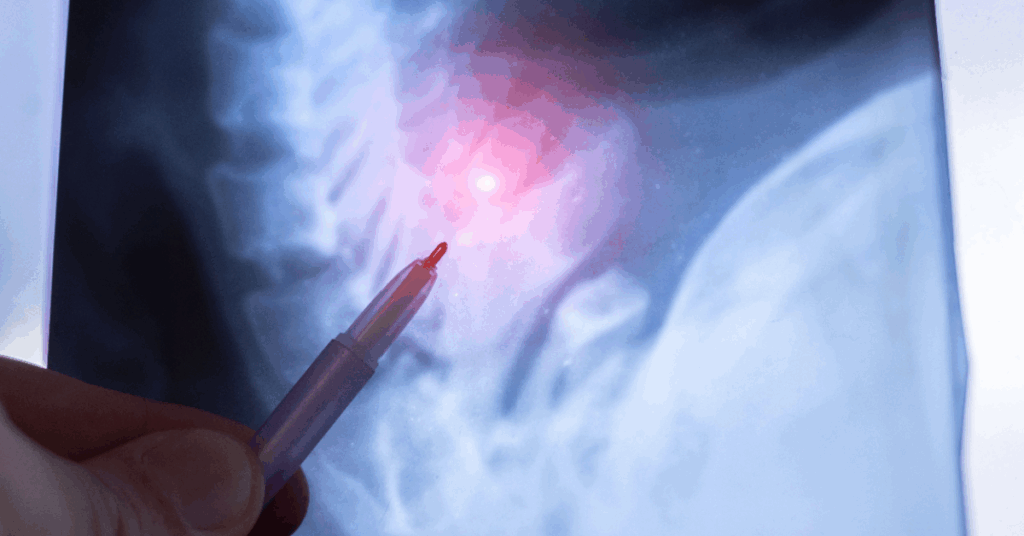 A hand points at a bright area on a medical scan.