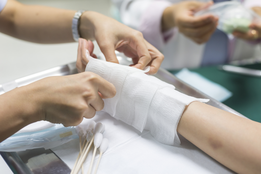 Photo of Hand Injury in hospital